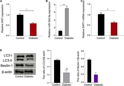 Long Non-coding RNA XIST Attenuates Diabetic Peripheral Neuropathy by Inducing Autophagy Through MicroRNA-30d-5p/sirtuin1 Axis